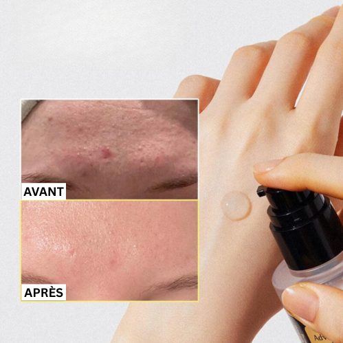 Advanced Snail 96 Mucin Power Essence